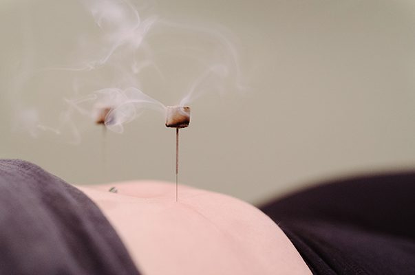 Deanna’s Guide to Moxibustion
