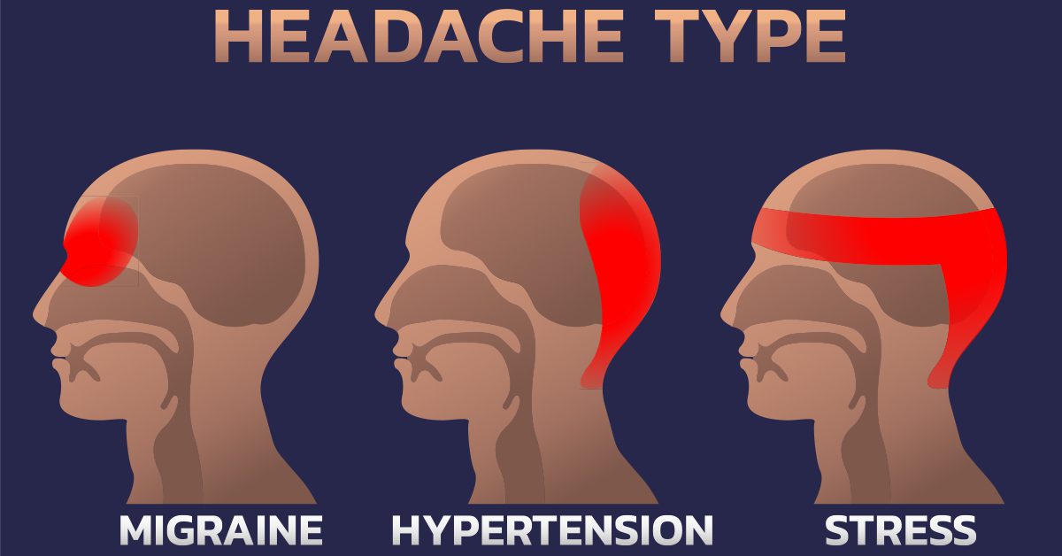 Headache and migrain types